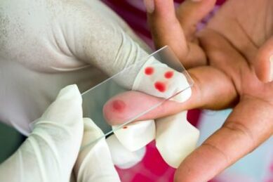 Diagnosis of pain in the joints of your fingers