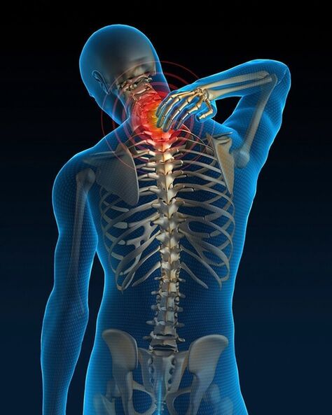 In the initial stage of cervical osteochondrosis treatment, neck pain increases